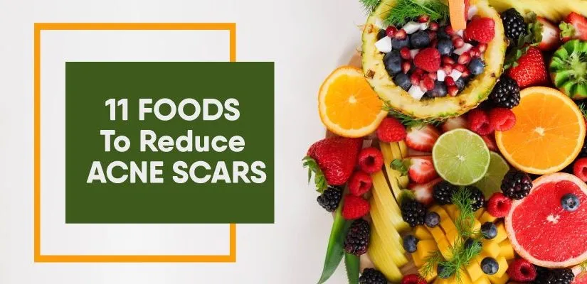 11 Foods to Reduce Acne Scars