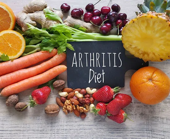 arthritis-diet
